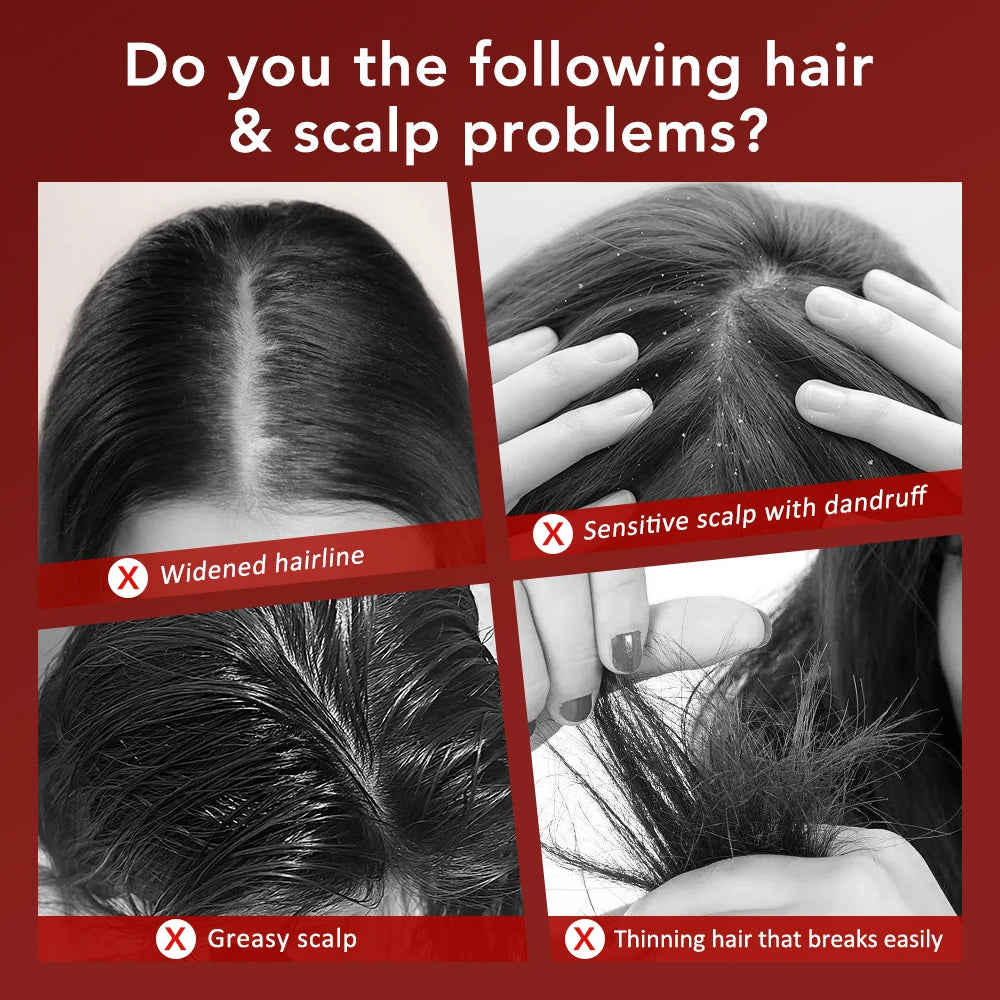 Electric Massage Comb with Vibration Red Light Therapy Scalp Brush Hair Growth Anti-Hair Loss Liquid Oil Applicator Hair Care